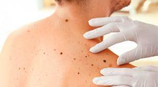 Prevención y concientización: llega Salvá tu Piel a Morón