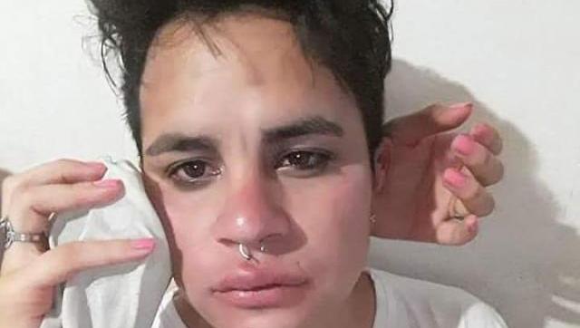 Violencia y discriminación: golpearon a otro joven por ser gay e intentaron robarle